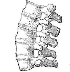 Ankylosing spondylitis