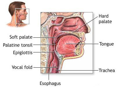 Tonsillitis